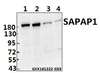 Western blot (WB) analysis of SAPAP1 (E817) polyclonal antibody at 1:500 dilution
Lane1:The Brain tissue lysate of Mouse(40ug)
Lane2:The Brain tissue lysate of Rat(40ug)
Lane3:U-87MG whole cell lysate(40ug)
Lane4:U-251MG whole cell lysate(40ug)