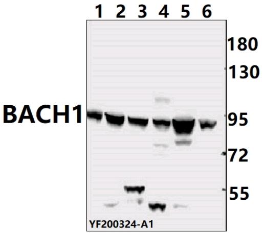 Western blot (WB) analysis of IKBKG pAb at 1:500 dilution
Lane1:The lung tissue lysate of Mouse(40ug)
Lane2:Aml-12 whole cell lysate(40ug)
Lane3:PMVEC whole cell lysate(40ug)
Lane4:HEK293T whole cell lysate(40ug)
Lane5:Hela whole cell lysate (40ug)
Lane6:SHSY5Y whole cell lysate (40ug)