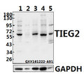 Western blot (WB) analysis of TIEG2 (F6) polyclonal antibody at 1:500 dilution
Lane1:HEK293T whole cell lysate(40ug)
Lane2:THP-1 whole cell lysate(40ug)
Lane3:SGC7901 whole cell lysate(40ug)
Lane4:H9C2 whole cell lysate(40ug)
Lane5:The Heart tissue lysate of Mouse(40ug)