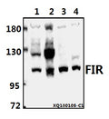 Western blot (WB) analysis of FIR (P364) pAb at 1:1000 dilution
Lane1:SGC7901 whole cell lysate(40ug)
Lane2:HEK293T whole cell lysate(40ug)
Lane3:PC12 whole cell lysate(40ug)
Lane4:AML-12 whole cell lysate(40ug)
