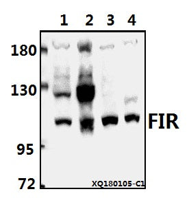 Western blot (WB) analysis of FIR (P364) pAb at 1:1000 dilution
Lane1:SGC7901 whole cell lysate(40ug)
Lane2:HEK293T whole cell lysate(40ug)
Lane3:PC12 whole cell lysate(40ug)
Lane4:AML-12 whole cell lysate(40ug)