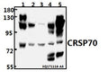 Western blot (WB) analysis of CRSP70 (S7) pAb at 1:500 dilution
Lane1:HEK293T whole cell lysate(40ug)
Lane2:PC3 whole cell lysate(40ug)
Lane3:K562 whole cell lysate(40ug)
Lane4:The Brain tissue lysate of Rat(40ug)
Lane5:The Kidney tissue lysate of Mouse(40ug)