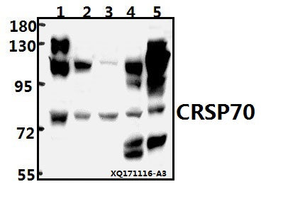 Western blot (WB) analysis of CRSP70 (S7) pAb at 1:500 dilution
Lane1:HEK293T whole cell lysate(40ug)
Lane2:PC3 whole cell lysate(40ug)
Lane3:K562 whole cell lysate(40ug)
Lane4:The Brain tissue lysate of Rat(40ug)
Lane5:The Kidney tissue lysate of Mouse(40ug)