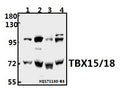 Western blot (WB) analysis of TBX15/18 (D164) pAb at 1:500 dilution
Lane1:A549 whole cell lysate(40ug)
Lane2:HEK293T whole cell lysate(40ug)
Lane3:The Lung tissue lysate of Rat(40ug)
Lane4:AML-12 whole cell lysate(40ug)