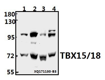 Western blot (WB) analysis of TBX15/18 (D164) pAb at 1:500 dilution
Lane1:A549 whole cell lysate(40ug)
Lane2:HEK293T whole cell lysate(40ug)
Lane3:The Lung tissue lysate of Rat(40ug)
Lane4:AML-12 whole cell lysate(40ug)