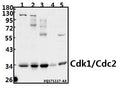 Western blot (WB) analysis of Cdk1/Cdc2 (N133) pAb at 1:500 dilution
Lane1:K562 whole cell lysate(40ug)
Lane2:PC3 whole cell lysate(40ug)
Lane3:HEK293T whole cell lysate(40ug)
Lane4:The Lung tissue lysate of Rat(40ug)
Lane5:3T3-L1 whole cell lysate(40ug)