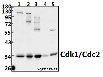 Western blot (WB) analysis of Cdk1/Cdc2 (N133) pAb at 1:500 dilution
Lane1:K562 whole cell lysate(40ug)
Lane2:PC3 whole cell lysate(40ug)
Lane3:HEK293T whole cell lysate(40ug)
Lane4:The Lung tissue lysate of Rat(40ug)
Lane5:3T3-L1 whole cell lysate(40ug)