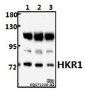 Western blot (WB) analysis of HKR1 (W154) pAb at 1:1000 dilution
Lane1:HEK293T whole cell lysate(20ug)
Lane2:A549 whole cell lysate(40ug)
Lane3:PC3 whole cell lysate(40ug)