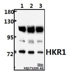 Western blot (WB) analysis of HKR1 (W154) pAb at 1:1000 dilution
Lane1:HEK293T whole cell lysate(20ug)
Lane2:A549 whole cell lysate(40ug)
Lane3:PC3 whole cell lysate(40ug)