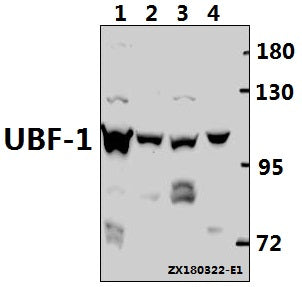 Western blot (WB) analysis of UBF-1 (E536) pAb at 1:500 dilution
Lane1:L02 whole cell lysate(40ug)
Lane2:H9C2 whole cell lysate(20ug)
Lane3:AML-12 whole cell lysate(20ug)
Lane4:A549 whole cell lysate(20ug)