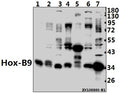 Western blot (WB) analysis of Hox-B9 (R237) pAb at 1:1000 dilution
Lane1:The Placenta tissue lysate of Rat(40ug)
Lane2:LOVO whole cell lysate(40ug)
Lane3:HCT116 whole cell lysate(40ug)
Lane4:The Testis tissue lysate of Rat(40ug)
Lane5:The Embryo tissue lysate of Mouse(40ug)
Lane6:Hela whole cell lysate(40ug)
Lane7:HEK293T whole cell lysate(40ug)