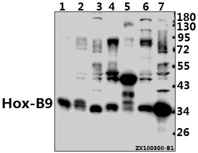 Western blot (WB) analysis of Hox-B9 (R237) pAb at 1:1000 dilution
Lane1:The Placenta tissue lysate of Rat(40ug)
Lane2:LOVO whole cell lysate(40ug)
Lane3:HCT116 whole cell lysate(40ug)
Lane4:The Testis tissue lysate of Rat(40ug)
Lane5:The Embryo tissue lysate of Mouse(40ug)
Lane6:Hela whole cell lysate(40ug)
Lane7:HEK293T whole cell lysate(40ug)