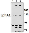 Western blot (WB) analysis of EphA1 (F568) pAb at 1:500 dilution
Lane1:PC3 whole cell lysate(40ug)
Lane2:HepG2 whole cell lysate(40ug)
Lane3:MCF-7 whole cell lysate(40ug)