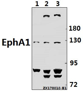 Western blot (WB) analysis of EphA1 (F568) pAb at 1:500 dilution
Lane1:PC3 whole cell lysate(40ug)
Lane2:HepG2 whole cell lysate(40ug)
Lane3:MCF-7 whole cell lysate(40ug)