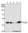 Western blot (WB) analysis of Ptx3 (Y27) polyclonal antibody at 1:500 dilution
Lane1:SGC7901 whole cell lysate(40ug)
Lane2:786-O whole cell lysate(40ug)
Lane3:HEK293T whole cell lysate(40ug)
Lane4:The Brain tissue lysate of Rat(40ug)
Lane5:The Brain tissue lysate of Mouse(40ug)