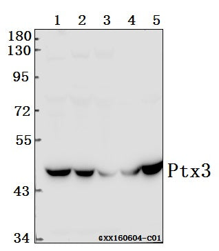 Western blot (WB) analysis of Ptx3 (Y27) polyclonal antibody at 1:500 dilution
Lane1:SGC7901 whole cell lysate(40ug)
Lane2:786-O whole cell lysate(40ug)
Lane3:HEK293T whole cell lysate(40ug)
Lane4:The Brain tissue lysate of Rat(40ug)
Lane5:The Brain tissue lysate of Mouse(40ug)