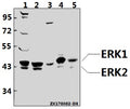 Western blot (WB) analysis of ERK1/2 (R189) pAb at 1:500 dilution
Lane1:HEK293T whole cell lysate(40ug)
Lane2:U-87MG whole cell lysate(40ug)
Lane3:HepG2 whole cell lysate(40ug)
Lane4:C6 whole cell lysate(40ug)
Lane5:MEF whole cell lysate(40ug)
