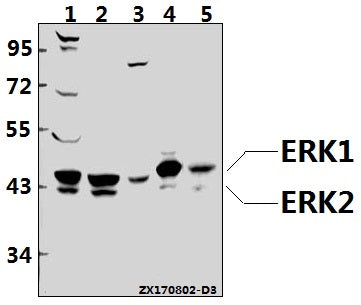 Western blot (WB) analysis of ERK1/2 (R189) pAb at 1:500 dilution
Lane1:HEK293T whole cell lysate(40ug)
Lane2:U-87MG whole cell lysate(40ug)
Lane3:HepG2 whole cell lysate(40ug)
Lane4:C6 whole cell lysate(40ug)
Lane5:MEF whole cell lysate(40ug)