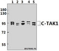 Western blot (WB) analysis of c-TAK1 (P8) pAb at 1:1000 dilution
Lane1:Hela whole cell lysate(40ug)
Lane2:HEK293T whole cell lysate(40ug)
Lane3:C6 whole cell lysate(40ug)
Lane4:CT26 whole cell lysate(40ug)