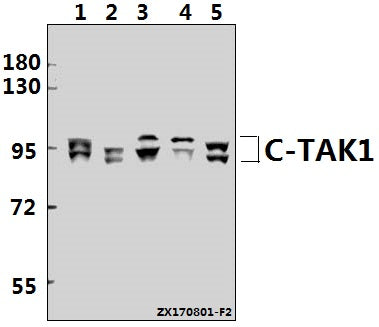 Western blot (WB) analysis of c-TAK1 (P8) pAb at 1:1000 dilution
Lane1:Hela whole cell lysate(40ug)
Lane2:HEK293T whole cell lysate(40ug)
Lane3:C6 whole cell lysate(40ug)
Lane4:CT26 whole cell lysate(40ug)
