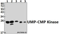Western blot (WB) analysis of UMP-CMP Kinase (E36) pAb at 1:1000 dilution
Lane1:Hela whole cell lysate(40ug)
Lane2:H9C2 whole cell lysate(40ug)
Lane3:MEF whole cell lysate(40ug)
Lane4:A549 whole cell lysate(40ug)
Lane5:HEK293T whole cell lysate(40ug)