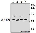 Western blot (WB) analysis of GRK5 (Q382) pAb at 1:1000 dilution
Lane1:PC3 whole cell lysate(20ug)
Lane2:HEK293T whole cell lysate(20ug)
Lane3:H9C2 whole cell lysate(20ug)
Lane4:MEF whole cell lysate(40ug)