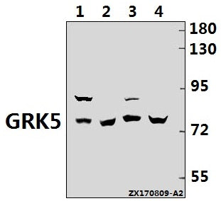 Western blot (WB) analysis of GRK5 (Q382) pAb at 1:1000 dilution
Lane1:PC3 whole cell lysate(20ug)
Lane2:HEK293T whole cell lysate(20ug)
Lane3:H9C2 whole cell lysate(20ug)
Lane4:MEF whole cell lysate(40ug)
