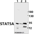 Western blot (WB) analysis of STAT5A pAb at 1:500 dilution
Lane1:SP2/0  whole cell lysate(40ug)
Lane2:SHSY5Y whole cell lysate(40ug)
Lane3:MCF-7 whole cell lysate(40ug)