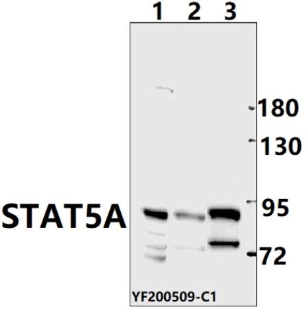 Western blot (WB) analysis of STAT5A pAb at 1:500 dilution
Lane1:SP2/0  whole cell lysate(40ug)
Lane2:SHSY5Y whole cell lysate(40ug)
Lane3:MCF-7 whole cell lysate(40ug)