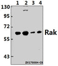 Western blot (WB) analysis of Rak (N103) pAb at 1:500 dilution
Lane1:L02 whole cell lysate(40ug)
Lane2:HEK293T whole cell lysate(40ug)
Lane3:CT26 whole cell lysate(40ug)
Lane4:C6 whole cell lysate(40ug)
