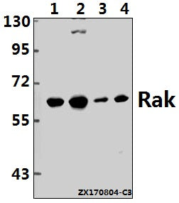 Western blot (WB) analysis of Rak (N103) pAb at 1:500 dilution
Lane1:L02 whole cell lysate(40ug)
Lane2:HEK293T whole cell lysate(40ug)
Lane3:CT26 whole cell lysate(40ug)
Lane4:C6 whole cell lysate(40ug)
