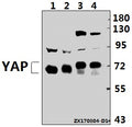 Western blot (WB) analysis of YAP (Q295) pAb at 1:500 dilution
Lane1:H9C2 whole cell lysate(40ug)
Lane2:MEF whole cell lysate(40ug)
Lane3:L02 whole cell lysate(40ug)
Lane4:PC3 whole cell lysate(40ug)