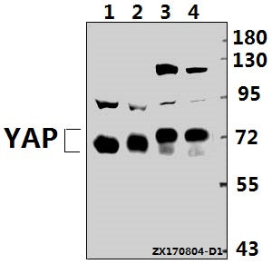 Western blot (WB) analysis of YAP (Q295) pAb at 1:500 dilution
Lane1:H9C2 whole cell lysate(40ug)
Lane2:MEF whole cell lysate(40ug)
Lane3:L02 whole cell lysate(40ug)
Lane4:PC3 whole cell lysate(40ug)