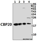 Western blot (WB) analysis of CBP20 (R21) pAb at 1:1000 dilution
Lane1:MCF-7 whole cell lysate(40ug)
Lane2:L02 whole cell lysate(40ug)
Lane3:CT26 whole cell lysate(40ug)
Lane4:H9C2 whole cell lysate(40ug)