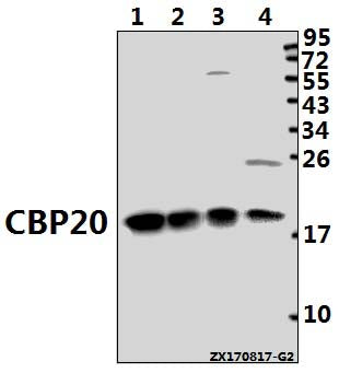 Western blot (WB) analysis of CBP20 (R21) pAb at 1:1000 dilution
Lane1:MCF-7 whole cell lysate(40ug)
Lane2:L02 whole cell lysate(40ug)
Lane3:CT26 whole cell lysate(40ug)
Lane4:H9C2 whole cell lysate(40ug)
