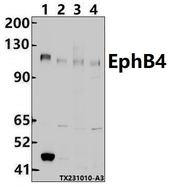 Western blot (WB) analysis of EphB4 (E601) polyclonal antibody at 1:500 dilution
Lane1:MCF-7 whole cell lysate(30ug)
Lane2:HepG2 whole cell lysate(30ug)
Lane3:3T3-L1 whole cell lysate(30ug)
Lane4:PC12 whole cell lysate(30ug)