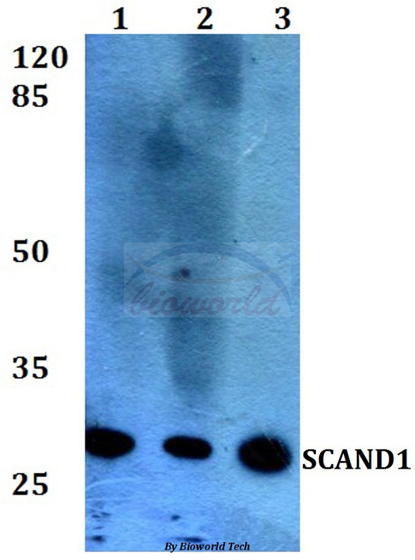 SCAND1 (E88) polyclonal antibody – Figure 1 of 1