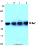 Casein Kinase Iγ2 (G7) polyclonal antibody – Figure 1 of 1