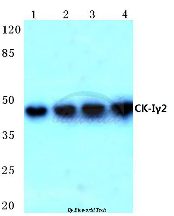 Casein Kinase Iγ2 (G7) polyclonal antibody – Figure 1 of 1