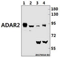 Western blot (WB) analysis of ADAR2 (R510) pAb at 1:1000 dilution
Lane1:L02 whole cell lysate(20ug)
Lane2:H9C2 whole cell lysate(40ug)
Lane3:CT26 whole cell lysate(40ug)
Lane4:MEF whole cell lysate(40ug)
