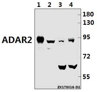 Western blot (WB) analysis of ADAR2 (R510) pAb at 1:1000 dilution
Lane1:L02 whole cell lysate(20ug)
Lane2:H9C2 whole cell lysate(40ug)
Lane3:CT26 whole cell lysate(40ug)
Lane4:MEF whole cell lysate(40ug)