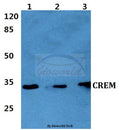 CREM (I106) polyclonal antibody – Figure 1 of 1