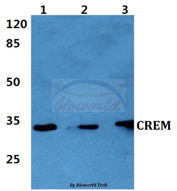 CREM (I106) polyclonal antibody – Figure 1 of 1