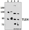 Western blot (WB) analysis of TLE4 (H190) pAb at 1:500 dilution
Lane1:U-87MG whole cell lysate(40ug)
Lane2:HEK293T whole cell lysate(10ug)
Lane3:The Testis tissue lysate of Mouse(40ug)
Lane4:The Testis tissue lysate of Rat(40ug)
