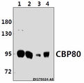 Western blot (WB) analysis of CBP80 (R5) pAb at 1:500 dilution
Lane1:K562 whole cell lysate(10ug)
Lane2:Hela whole cell lysate(20ug)
Lane3:The Brain tissue lysate of Mouse(40ug)
Lane4:The Brain tissue lysate of Rat(40ug)