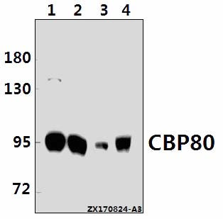 Western blot (WB) analysis of CBP80 (R5) pAb at 1:500 dilution
Lane1:K562 whole cell lysate(10ug)
Lane2:Hela whole cell lysate(20ug)
Lane3:The Brain tissue lysate of Mouse(40ug)
Lane4:The Brain tissue lysate of Rat(40ug)