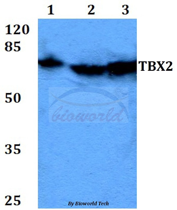 TBX2 (N280) polyclonal antibody – Figure 1 of 1