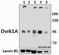 Western blot (WB) analysis of Dyrk1A (Q39) pAb at 1:500 dilution
Lane1:Hela whole cell lysate(20ug)
Lane2:MCF-7 whole cell lysate(10ug)
Lane3:A549 whole cell lysate(40ug)
Lane4:H9C2 whole cell lysate(40ug)
Lane5:MEF whole cell lysate(40ug)