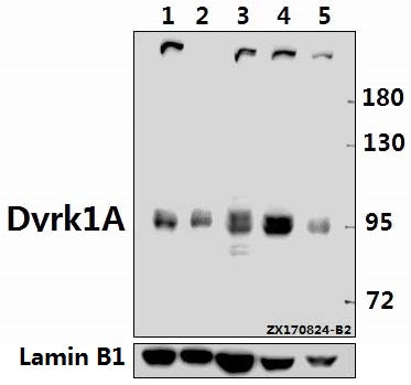 Western blot (WB) analysis of Dyrk1A (Q39) pAb at 1:500 dilution
Lane1:Hela whole cell lysate(20ug)
Lane2:MCF-7 whole cell lysate(10ug)
Lane3:A549 whole cell lysate(40ug)
Lane4:H9C2 whole cell lysate(40ug)
Lane5:MEF whole cell lysate(40ug)