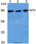 GIT2 (D391) polyclonal antibody – Figure 1 of 1